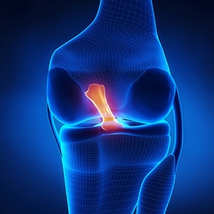 ACL Injury Treatment