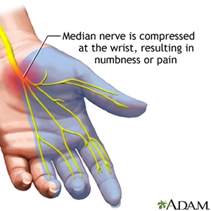 Managing Hand Pain