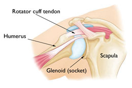 Shoulder Replacement